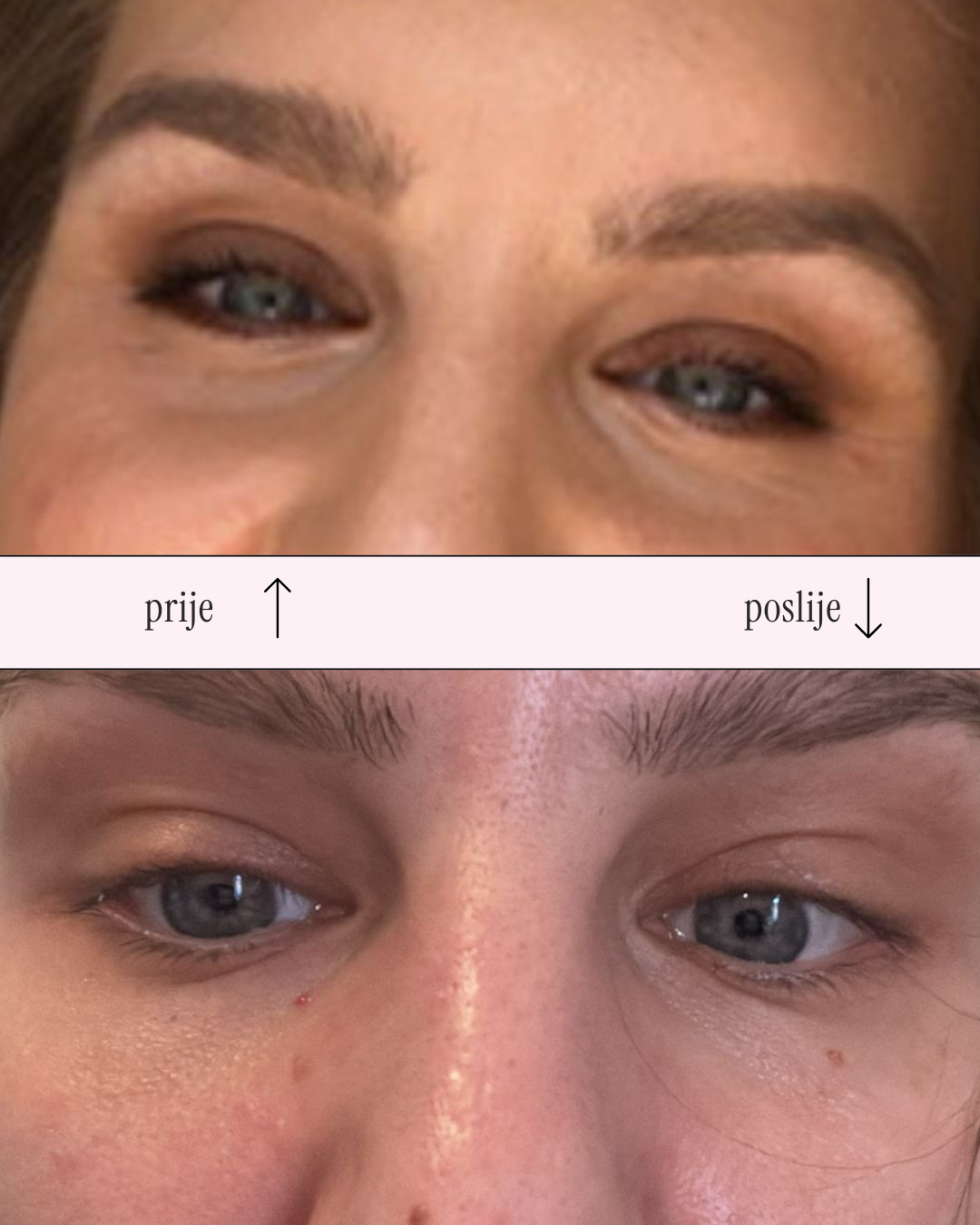 Slika prije i poslije korištenja Maleena Awaken eye cream