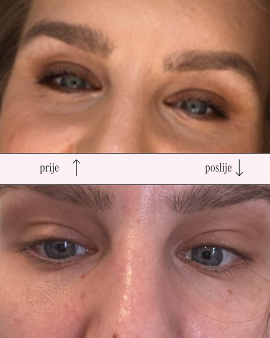 Slika prije i poslije korištenja Maleena Awaken eye cream
