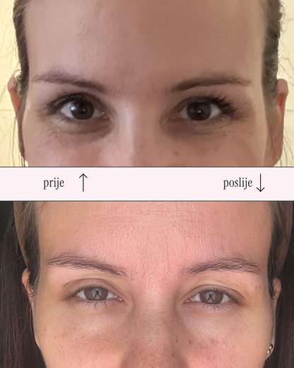 Awaken eye cream