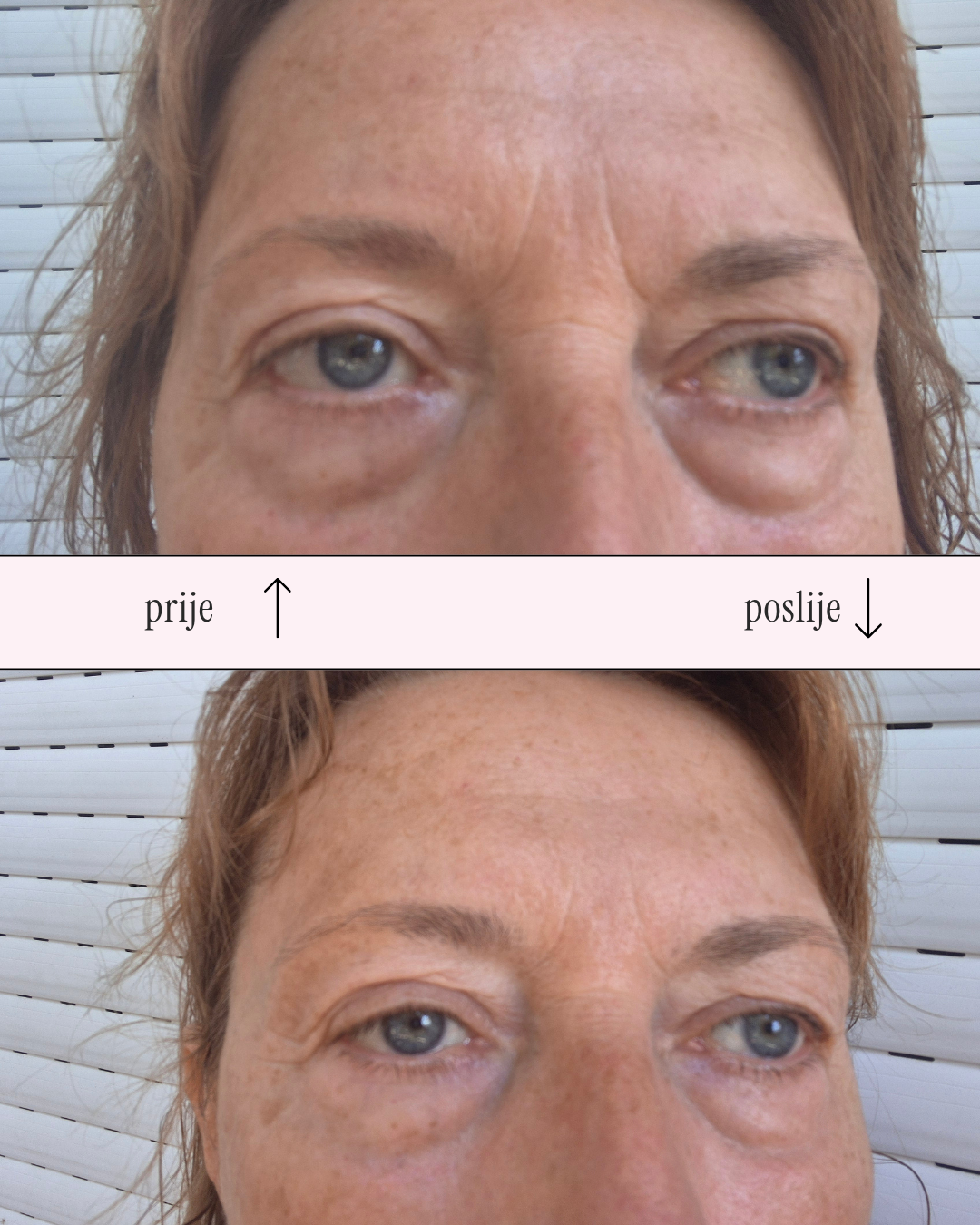 Awaken eye cream