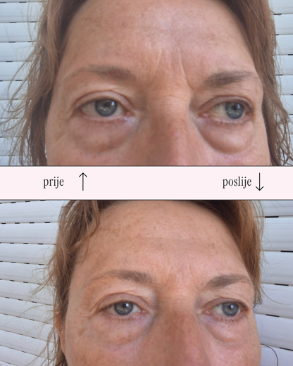 Awaken eye cream